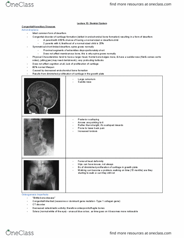 MEDRADSC 3J03 Lecture Notes - Lecture 10: Osteogenesis Imperfecta, Saddle Nose, Dwarfism thumbnail