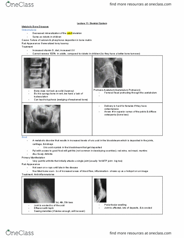 MEDRADSC 3J03 Lecture Notes - Lecture 11: Osteomalacia, Acetabulum, Tophus thumbnail