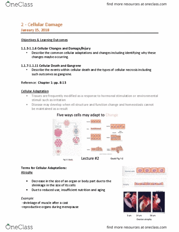 MEDRADSC 1B03 Lecture Notes - Lecture 2: Cellular Adaptation, Gangrene, Menopause thumbnail