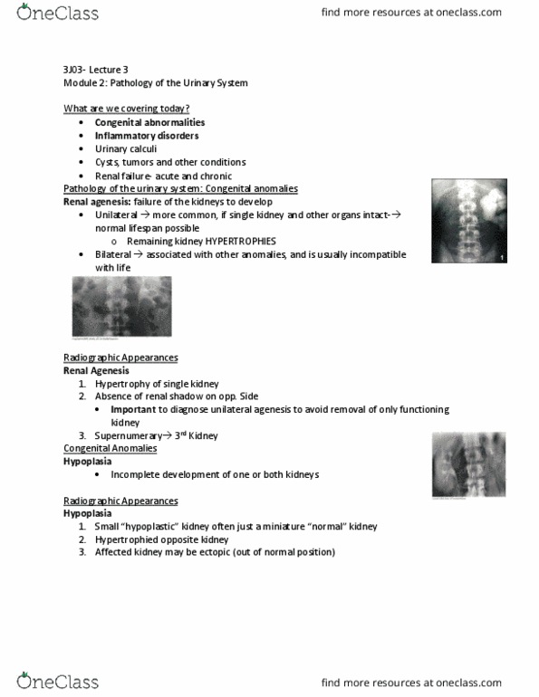 MEDRADSC 3J03 Lecture Notes - Lecture 3: Renal Agenesis, Kidney Stone Disease, Congenital Disorder thumbnail