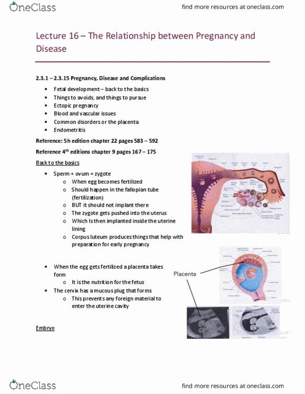 MEDRADSC 1B03 Lecture Notes - Lecture 16: Ectopic Pregnancy, Corpus Luteum, Endometritis thumbnail
