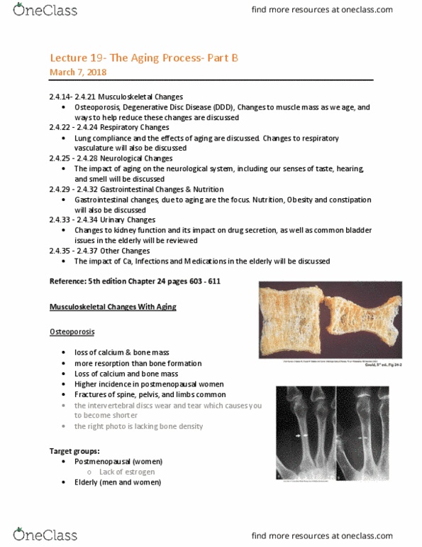 MEDRADSC 1B03 Lecture Notes - Lecture 19: Bone Resorption, Menopause, Urinary Tract Infection thumbnail
