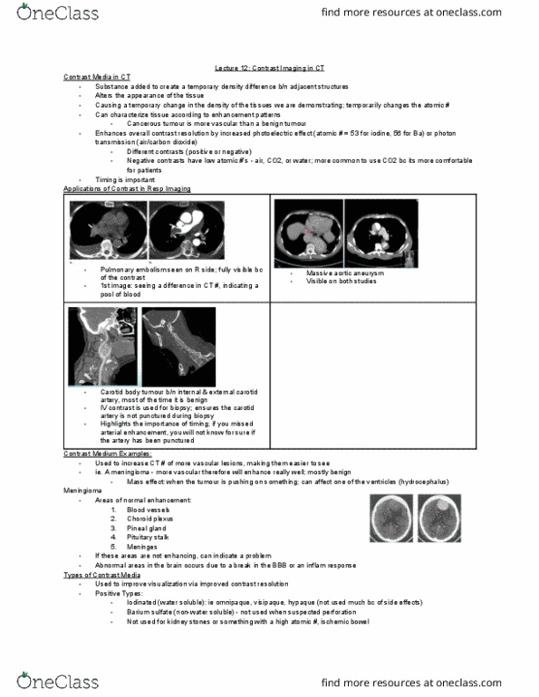 MEDRADSC 3K03 Lecture Notes - Lecture 12: External Carotid Artery, Benign Tumor, Aortic Aneurysm thumbnail