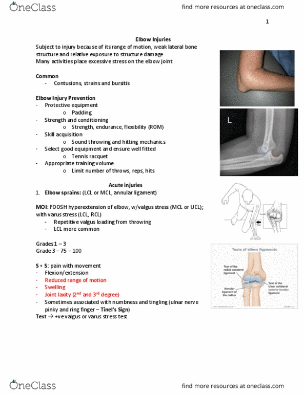 KIN 3160 Lecture Notes - Lecture 19: Tennis Elbow, Annular Ligament Of Radius, Ulnar Nerve thumbnail