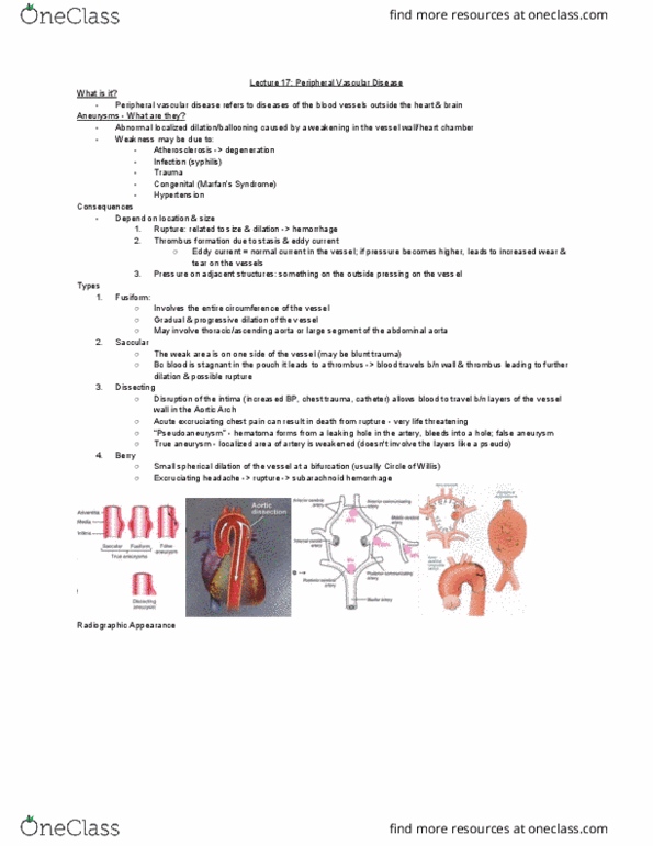 MEDRADSC 3J03 Lecture Notes - Lecture 17: Peripheral Artery Disease, Subarachnoid Hemorrhage, Chest Injury thumbnail