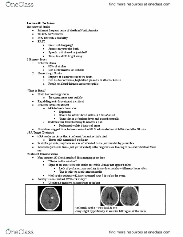 MEDRADSC 3DA3 Lecture Notes - Lecture 8: Stroke, Embolectomy, Tresor thumbnail