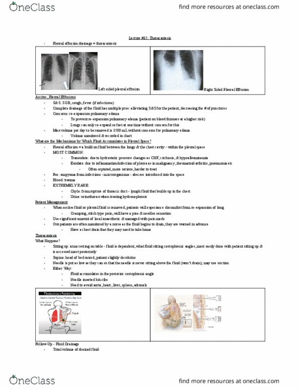 MEDRADSC 3C03 Lecture Notes - Lecture 15: Pleural Effusion, Costodiaphragmatic Recess, Pleural Cavity thumbnail