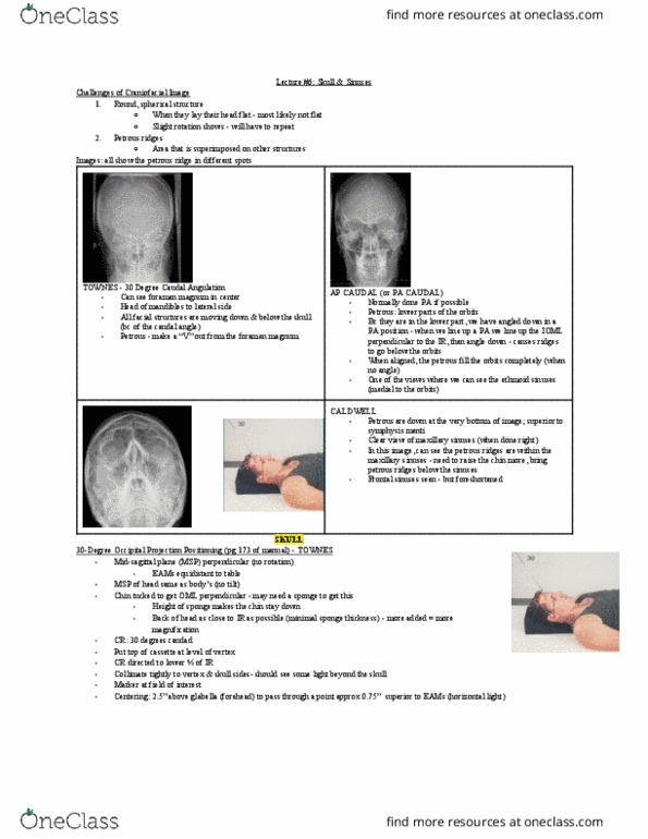 MEDRADSC 3L03 Lecture Notes - Lecture 6: Maxillary Sinus, Mandibular Symphysis, Foramen Magnum thumbnail
