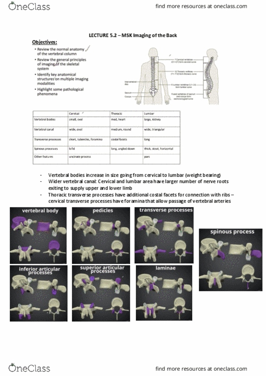 ANAT30007 Lecture Notes - Lecture 11: Foramen Magnum, Vertebral Compression Fracture, Nerve Root thumbnail
