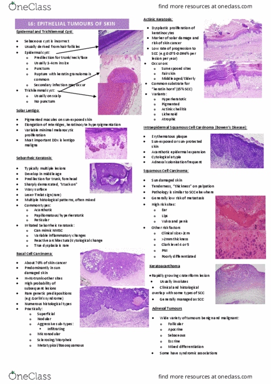 IMED3004 Lecture Notes - Lecture 6: Palpation, Keratinocyte, Basal-Cell Carcinoma thumbnail