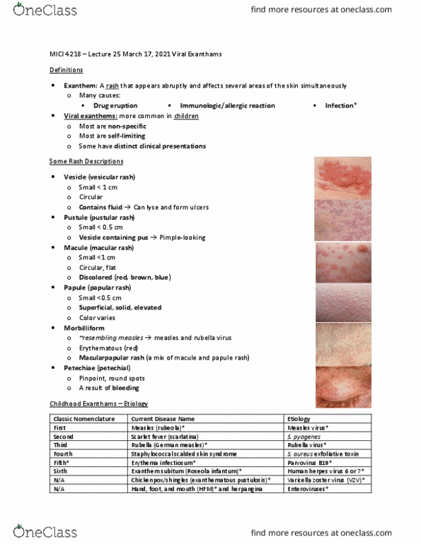 MICI 4218 Lecture Notes - Lecture 25: Roseola, Varicella Zoster Virus, Fifth Disease thumbnail