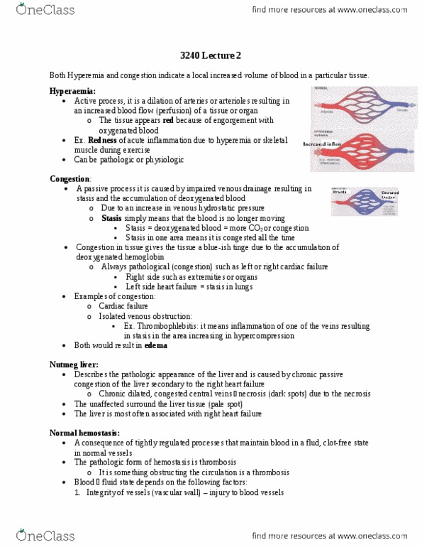 Pathology 3240A Lecture Notes - Lecture 13: Extracellular Fluid, Embolus, Varicose Veins thumbnail