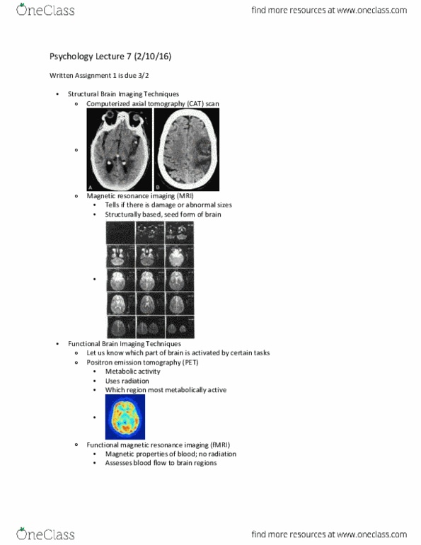 PSYC W1001 Lecture Notes - Lecture 7: Functional Magnetic Resonance Imaging, Positron Emission Tomography, Transcranial Magnetic Stimulation thumbnail
