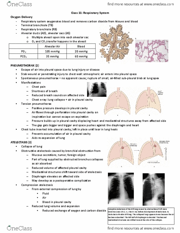 HSS 3305 Lecture Notes - Lecture 11: Pneumocystis Pneumonia, Pneumocystis Jirovecii, Airway Obstruction thumbnail