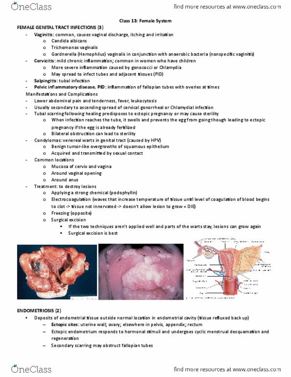 HSS 3305 Lecture Notes - Lecture 13: Endometrioid Tumor, Cystadenoma, Staphylococcus thumbnail