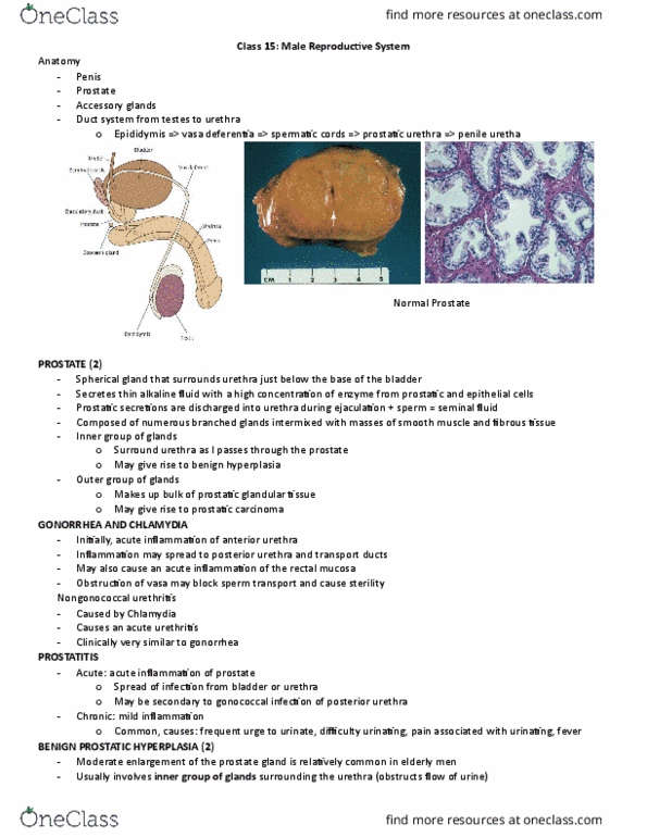 HSS 3305 Lecture Notes - Lecture 15: Arteriosclerosis, Varicose Veins, Choriocarcinoma thumbnail