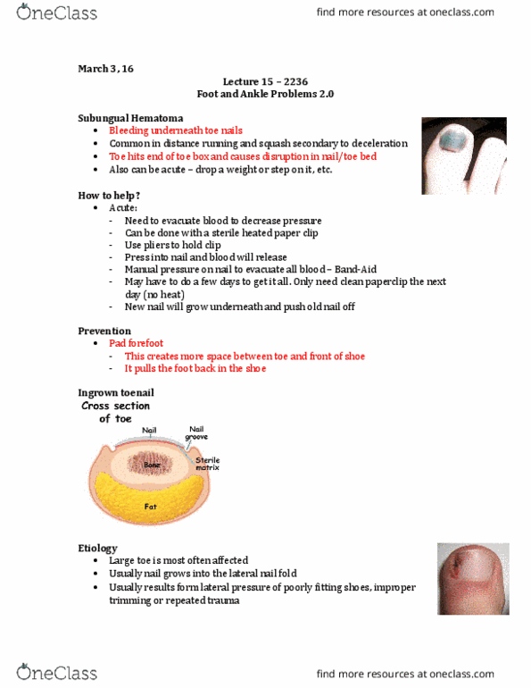 Kinesiology 2236A/B Lecture Notes - Lecture 15: Anterior Talofibular Ligament, Calcaneofibular Ligament, Ligament thumbnail