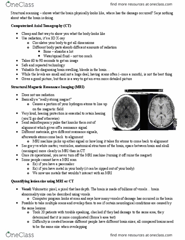 PSYC 301 Lecture Notes - Lecture 5: Cerebral Circulation, Functional Magnetic Resonance Imaging, Neuroplasticity thumbnail