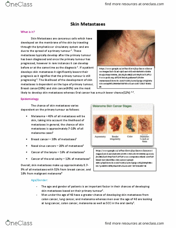 MEDRADSC 2T03 Lecture Notes - Lecture 9: Melanoma, Economic And Social Research Council, Breast Cancer thumbnail