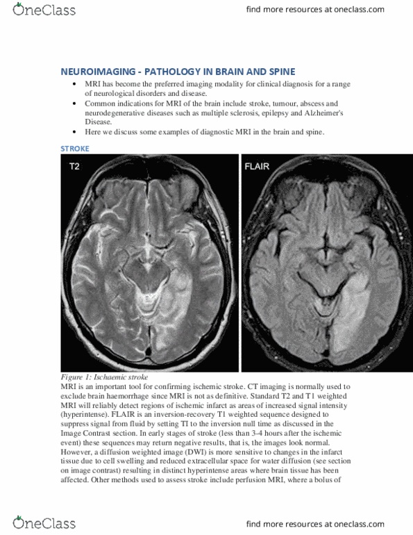 MEDRADSC 2Z03 Lecture Notes - Lecture 9: Brain Abscess, Multiple Sclerosis, Perfusion thumbnail