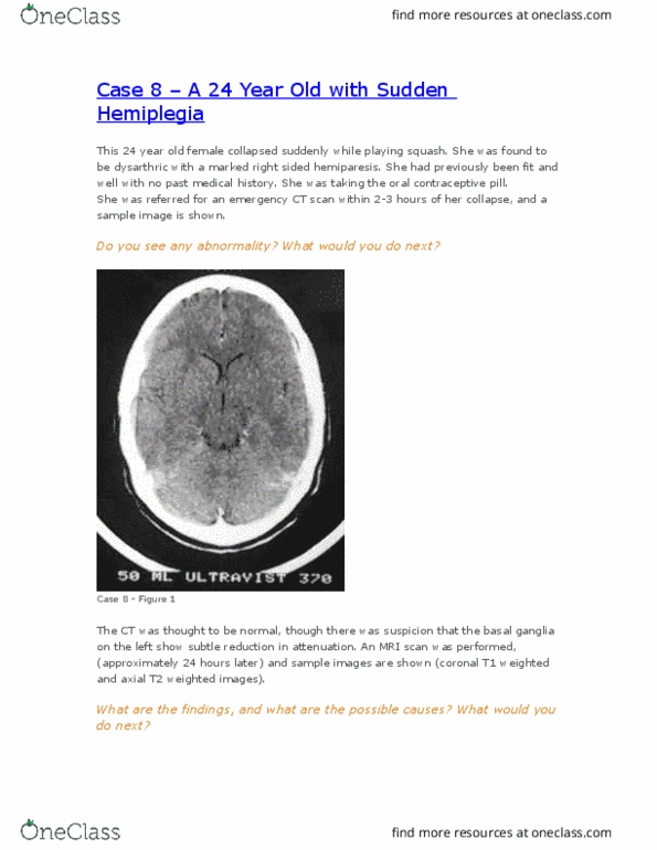 MEDRADSC 2Z03 Lecture Notes - Lecture 24: Basal Ganglia, Combined Oral Contraceptive Pill, Magnetic Resonance Imaging thumbnail