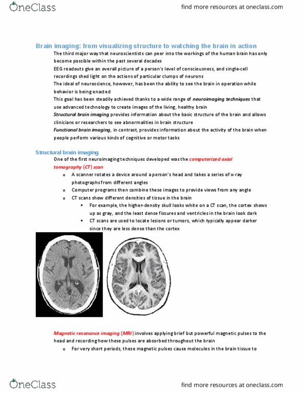 PSYA01H3 Chapter Notes - Chapter 3: Magnetic Resonance Imaging, Visual Cortex, Positron thumbnail